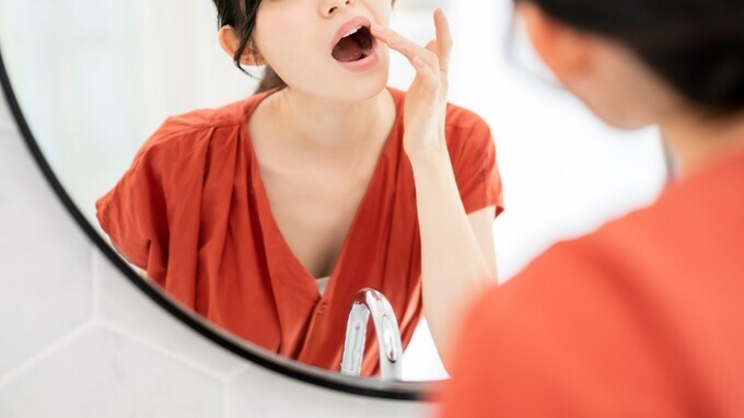 早くセカンドオピニオンを受けておけば…。「治らない口内炎」の正体【歯科医師が解説】
