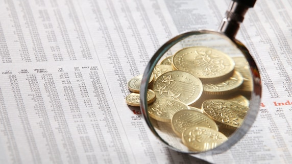 スプレッドやドル離れと逆行する金価格…市場が訴える“潜在的なリスク”