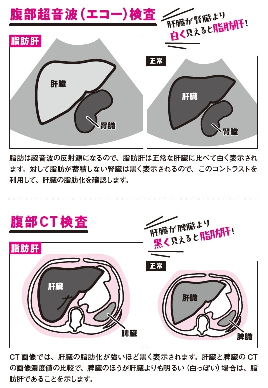 出典：『専門医が教える1分で肝臓から脂肪が落ちる食べ方決定版』（KADOKAWA）
