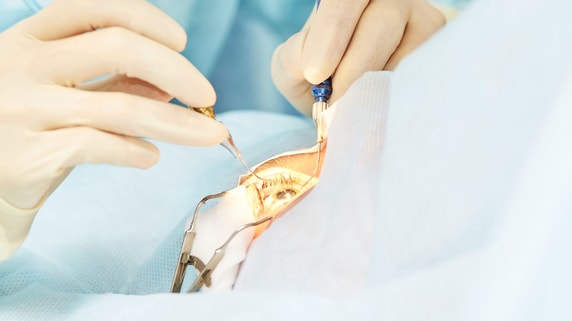 「目にイクラ丼が見えた」2.5万回執刀の専門医が初めて体験した、白内障手術中の「不思議な世界」