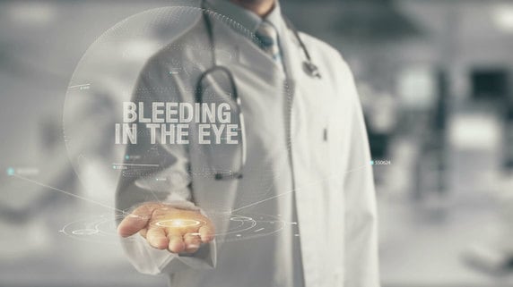 目がチカチカする…「疑うべき病気と対処法」を眼科院長が解説