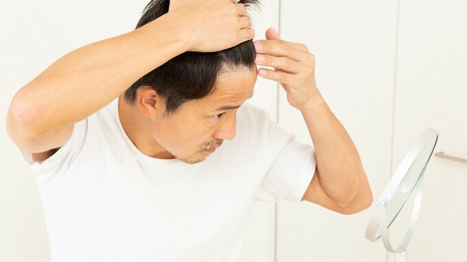 【薄毛】あれっ、また抜けた？…AGAの「簡単な」見分け方【専門医が解説】