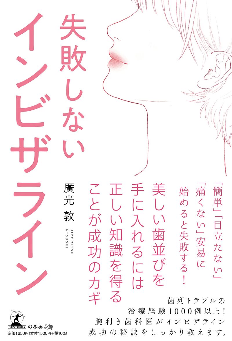 失敗しないインビザライン