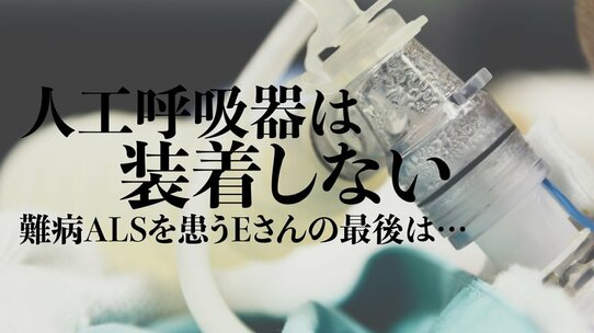 医師「後悔でいっぱい。」難病ALSの患者…最期の1日の出来事