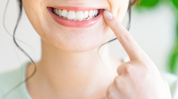 銀歯にしたくないなら知るべき…〈白い人工歯〉の落とし穴【歯科医師が解説】