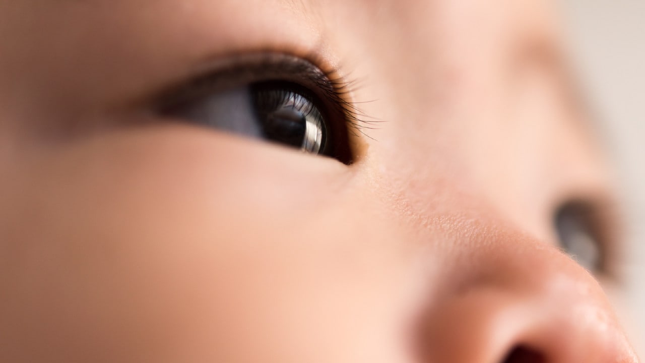 子どもの「黒目が大きくてかわいい」は緑内障のサイン?知っておくべき緑内障のタイプと特徴【眼科専門医が解説】