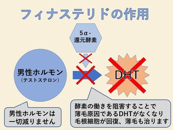 ［図表2］フィナステリドの作用　(＜東京メモリアルクリニックHPより転載＞)