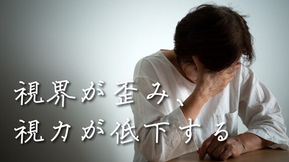 自然完治しない!急激な「視力低下・視界の歪み」には要注意