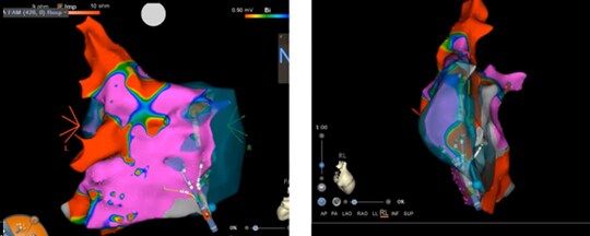 ［図表5］3次元画像システム③