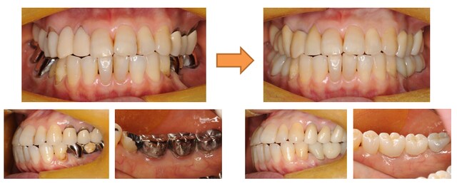 写真提供：オーラルケア