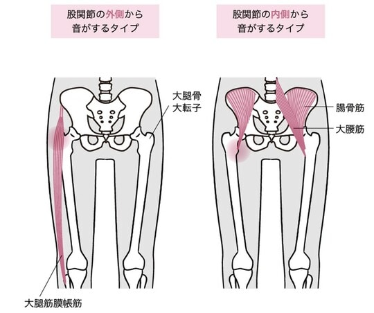 ［図表2］弾発股で音がするしくみ