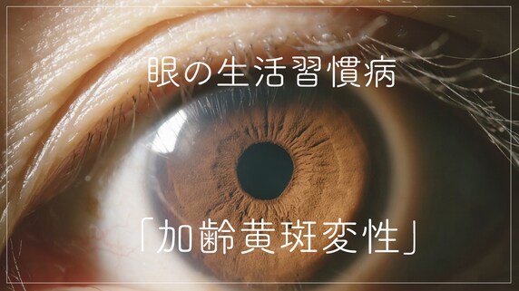 眼の生活習慣病「加齢黄斑変性」…タイプ別の治療法とは?