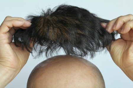 苦痛の日々だった。（写真はイメージです）