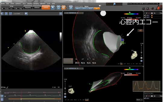 ［図表3］3次元画像システム①
