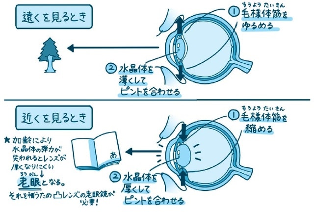 出所：梶原一人氏の著書『放っておくと怖い目の症状25』（ダイヤモンド社）より引用