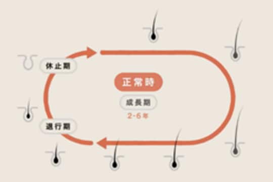 ［図表1］正常の毛周期（オンラインAGA診療「Oops-HAIR」より転載）
