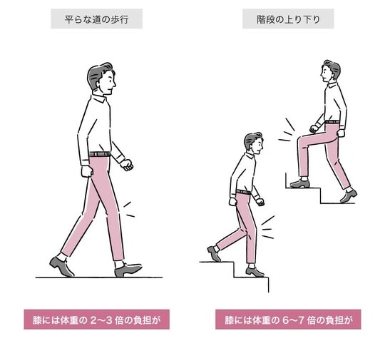 ［画像1］歩行の際にかかる膝への負担