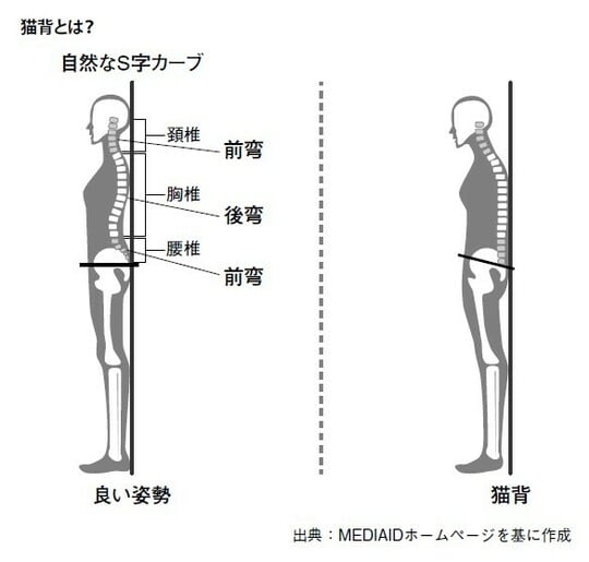 出所：『ねこ背が気になったら骨粗鬆症を疑いなさい』（幻冬舎メディアコンサルティング）より抜粋