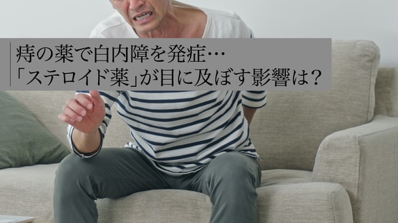 痔の薬で白内障を発症…「ステロイド薬」が目に及ぼす影響は?